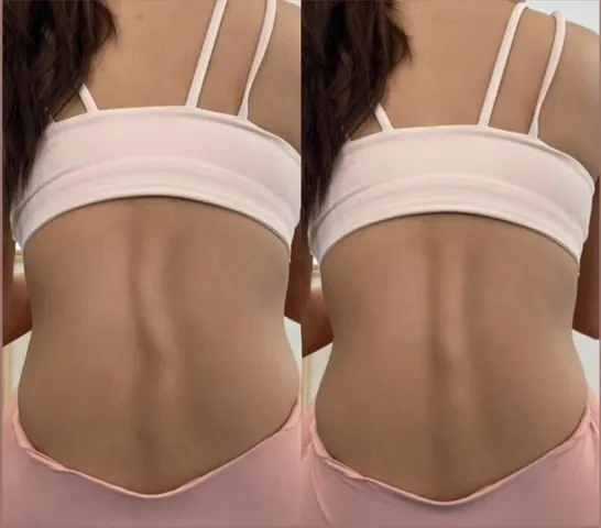 ภาพเปรียบเทียบบริเวณหลังของผู้เรียนในชุดสีชมพู