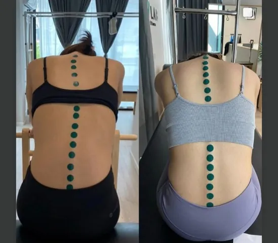 ภาพเปรียบเทียบแนวหลังของผู้เรียนขณะก้ม
