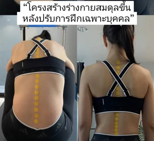 ภาพเปรียบเทียบผู้เรียนขณะก้มและยืน